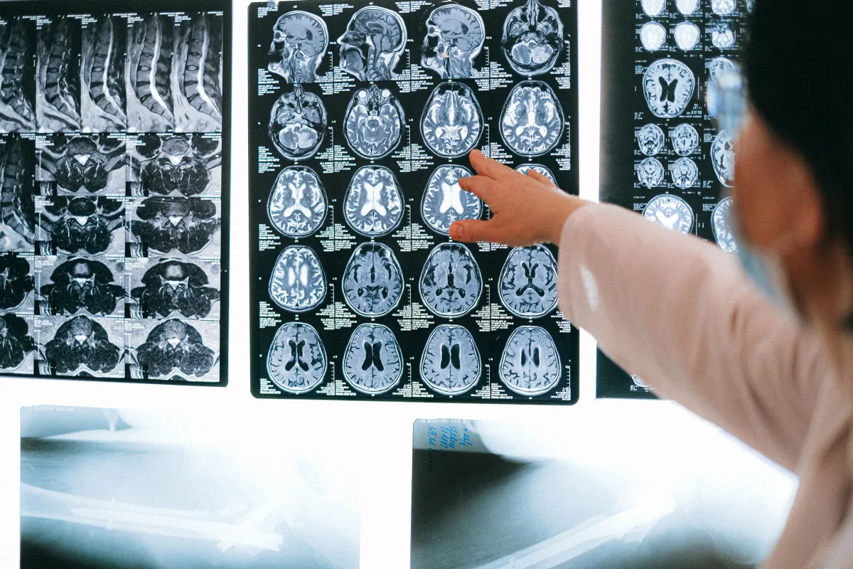 Prostate MRI in the UK: Cost and What to Expect
