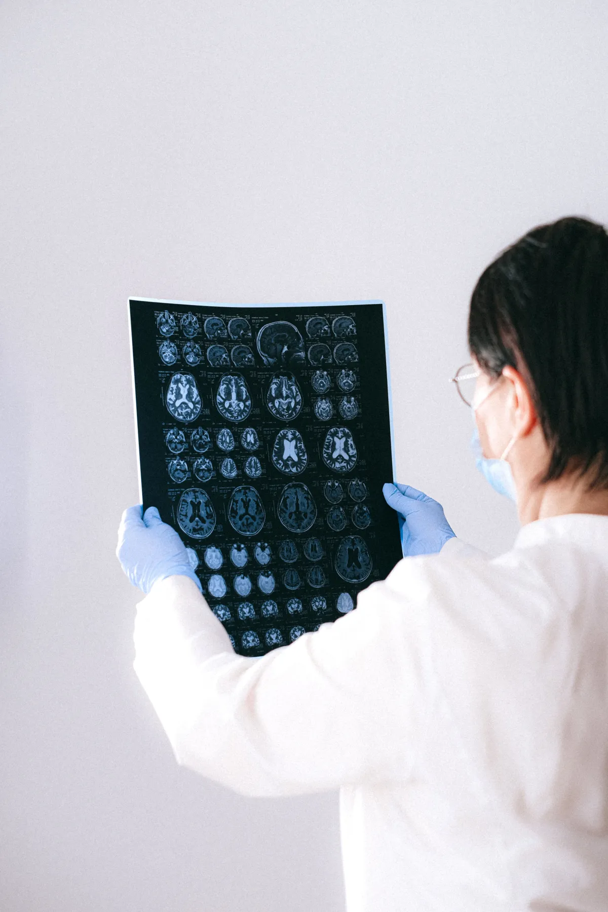 Doctor reviewing MRI brain scan results