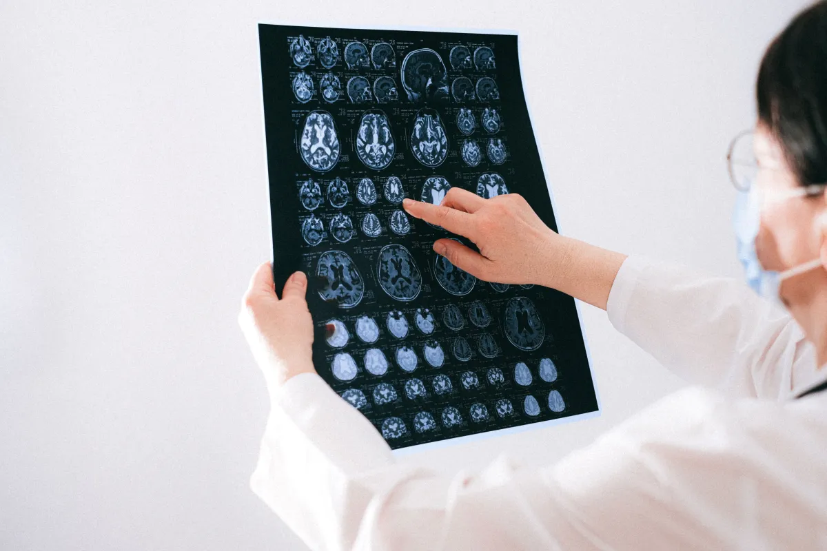 Brain MRI Cost in Houston (2026)